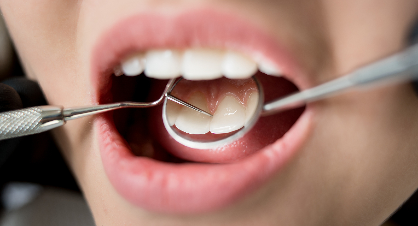 Breathing Easy: The Role of Airway Dentistry in West Los Angeles, CA